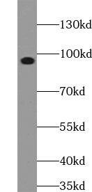 ACAP3 Antibody - BSA Free