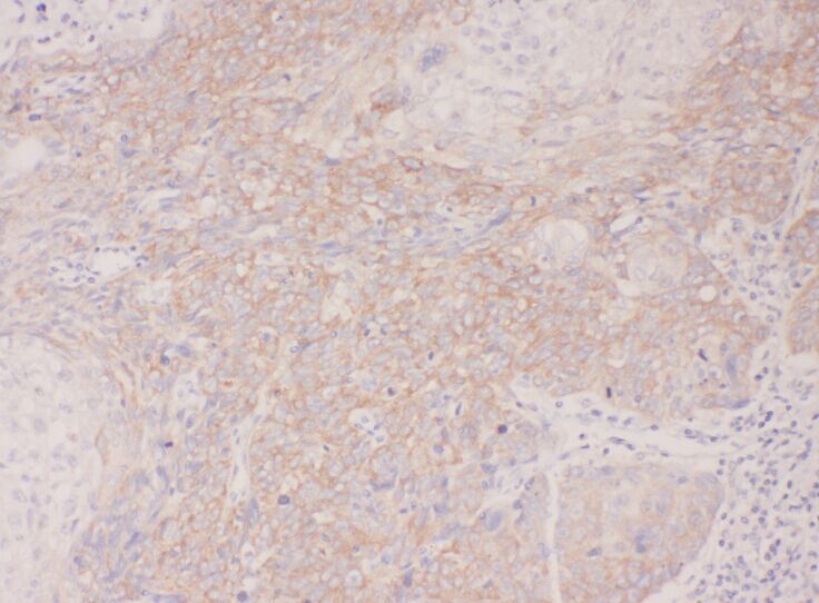 CENTB1 Antibody - BSA Free