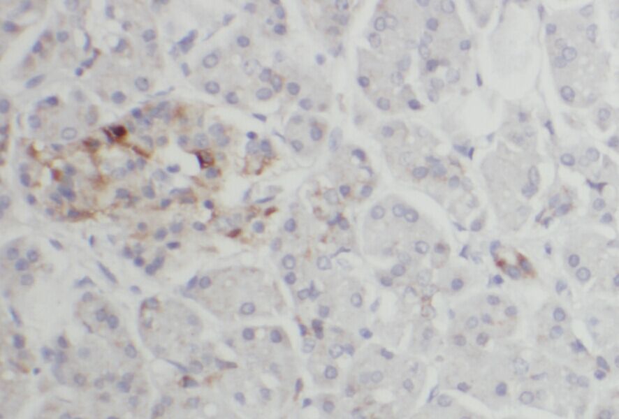 ACAD10 Antibody - BSA Free