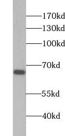 ABLIM2 Antibody - BSA Free
