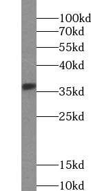 ABHD6 Antibody - BSA Free