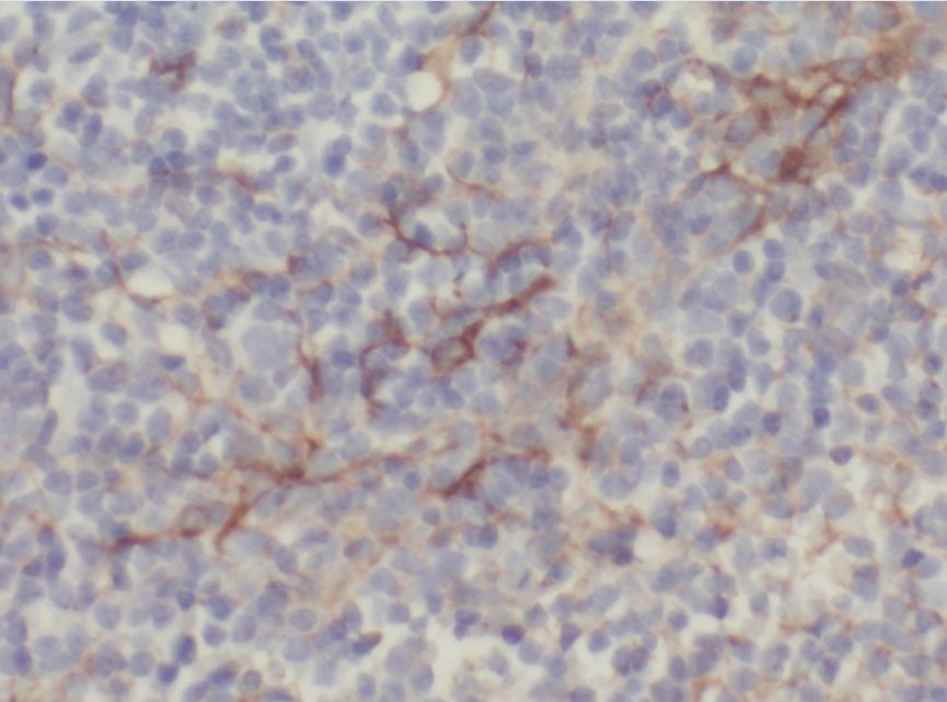 ABHD2 Antibody - BSA Free