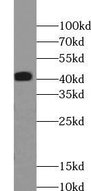 ABHD12B Antibody - BSA Free