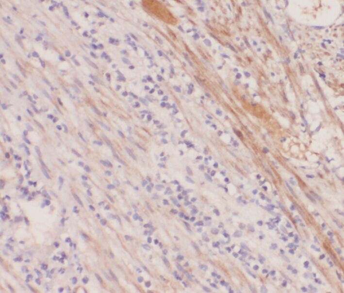 ABHD12B Antibody - BSA Free
