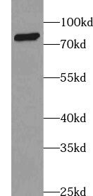ABCD2 Antibody - BSA Free