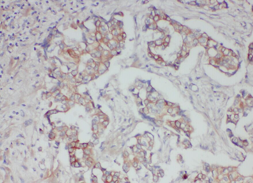 ABCB6 Antibody - BSA Free