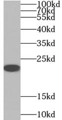 Serotonin N-acetyltransferase Antibody - BSA Free
