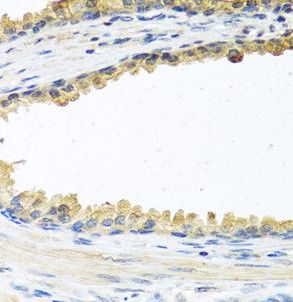 Cochlin Antibody - BSA Free