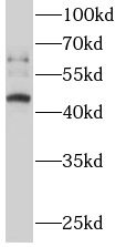 ERO1LB Antibody - BSA Free
