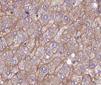 GAGE8 Antibody - BSA Free