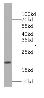 GAGE8 Antibody - BSA Free