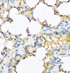 TSH beta Antibody - BSA Free