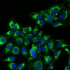 TSH beta Antibody - BSA Free