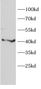alpha 1B-Glycoprotein Antibody - BSA Free