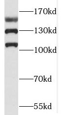 RAB3GAP2 Antibody - BSA Free