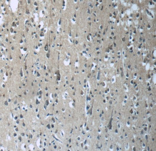 RAB3GAP2 Antibody - BSA Free