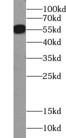 Serpin A3/alpha 1-Antichymotrypsin Antibody - BSA Free