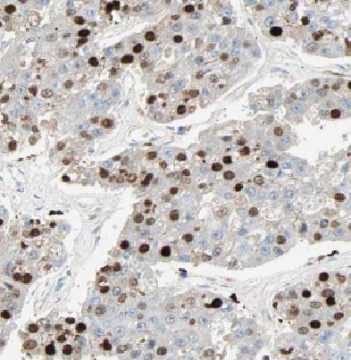 HIST1H2BD Antibody - BSA Free