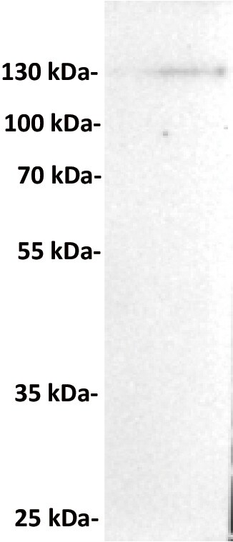 CD21 Antibody (DMC280) - Chimeric