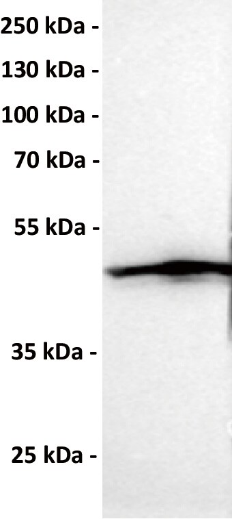 CCR1 Antibody (DMC465) - Chimeric
