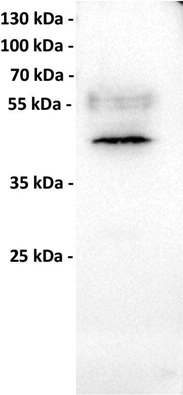 MICA Antibody (7F12) - Chimeric