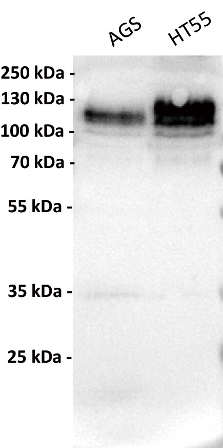 Cadherin-17 Antibody (5F5) - Chimeric