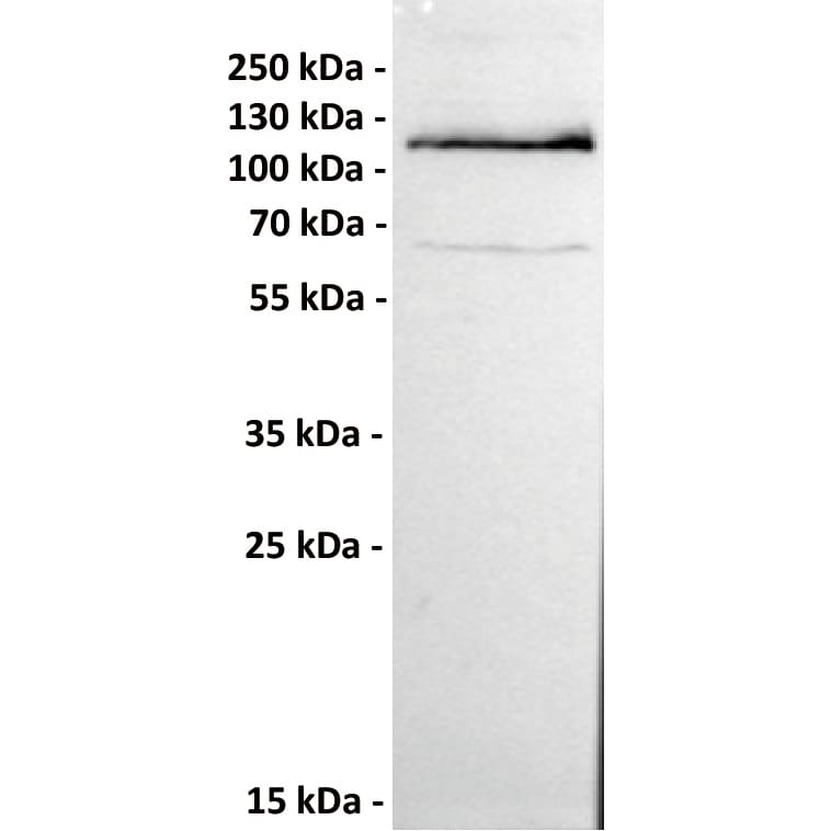 ROR1 Antibody (151A5) - Chimeric