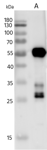 DcCoV Nucleoprotein Antibody - (HKU23-368F) DcCoV Nucleoprotein Antibody - (HKU23-368F)