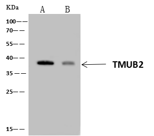 TMUB2 Antibody - Azide and BSA Free TMUB2 Antibody - Azide and BSA Free
