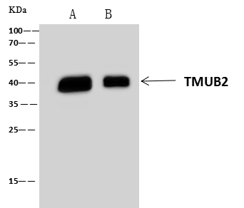 TMUB2 Antibody - Azide and BSA Free TMUB2 Antibody - Azide and BSA Free