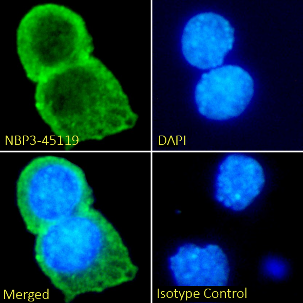 CCL2/JE/MCP-1 Antibody (11k2) - Chimeric - BSA Free CCL2/JE/MCP-1 Antibody (11k2) - Chimeric - BSA Free