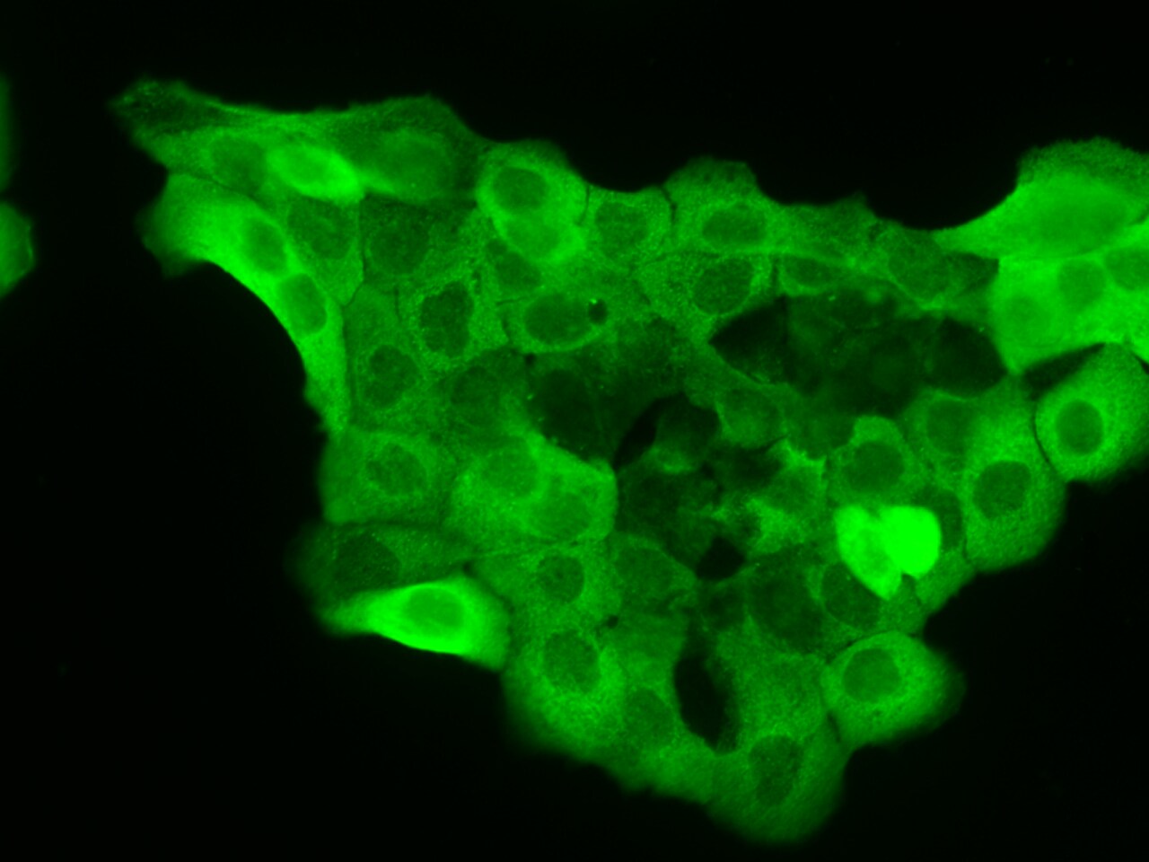 TMUB2 Antibody - Azide and BSA Free TMUB2 Antibody - Azide and BSA Free