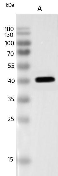 Human Mastadenovirus E Fiber Antibody Human Mastadenovirus E Fiber Antibody