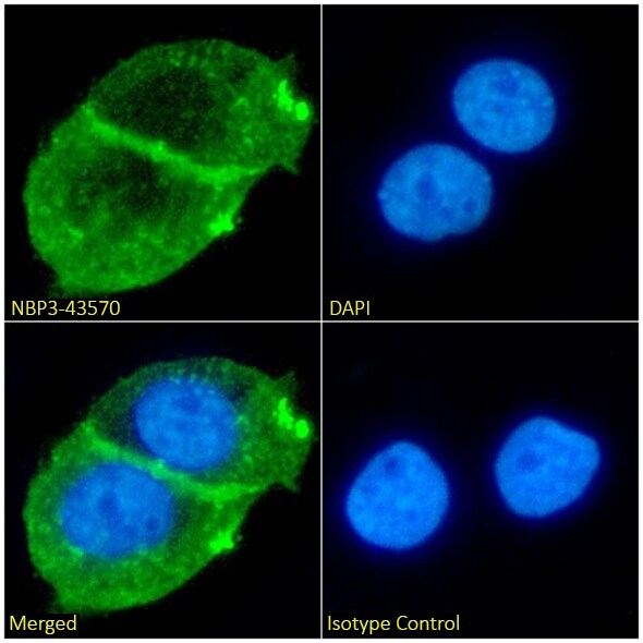 Beta Dystroglycan Antibody (P38G1) - BSA Free Beta Dystroglycan Antibody (P38G1) - BSA Free