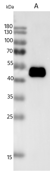 Vaccinia Virus B18R Antibody Vaccinia Virus B18R Antibody