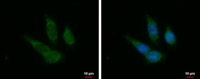 PTOV1 Antibody
