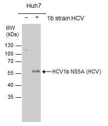 HCV-NS5a Antibody