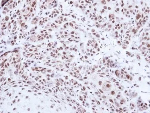 PRPF39 Antibody
