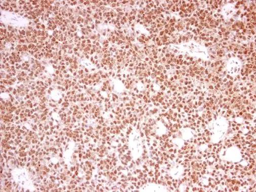 PRPF39 Antibody
