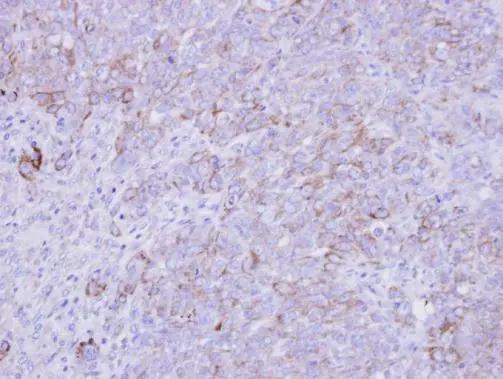 SLC26A8 Antibody