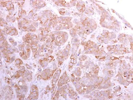 SLC26A8 Antibody