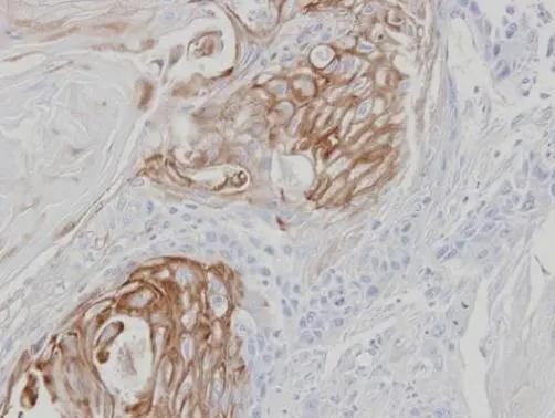 ZPBP Antibody