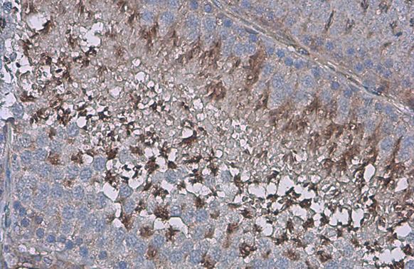 ZPBP Antibody