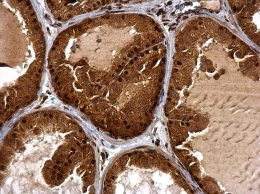 BTG1 Antibody