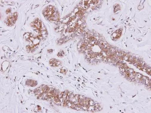 FSD2 Antibody