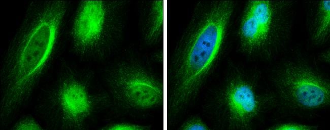 CCDC170 Antibody