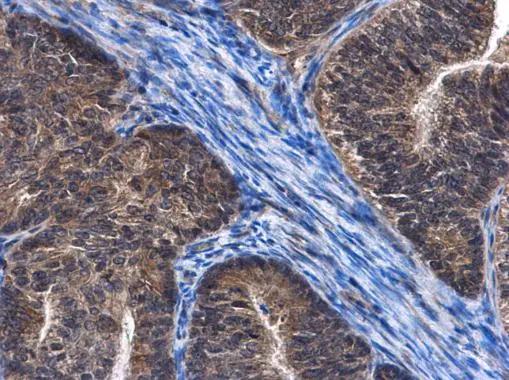 CCDC170 Antibody