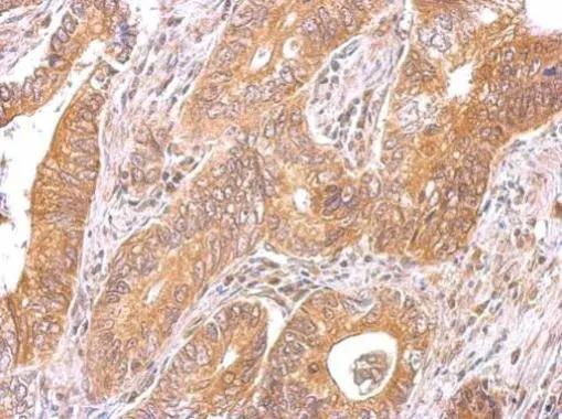 CCDC170 Antibody