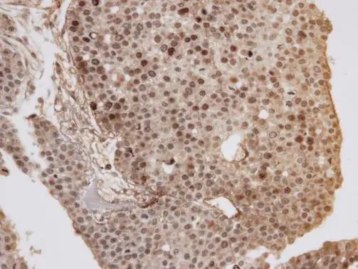 GOLGA6B Antibody