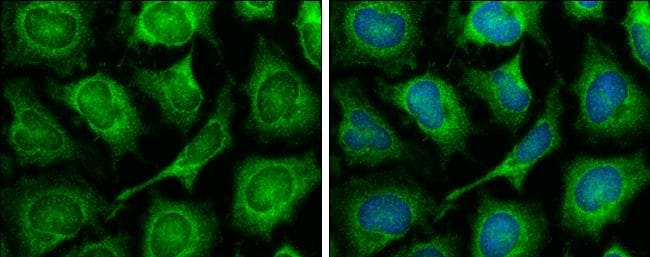 TOMM7 Antibody